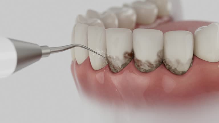 Reliable Dental contractor in Kountze, TX by Smile Center Dentistry